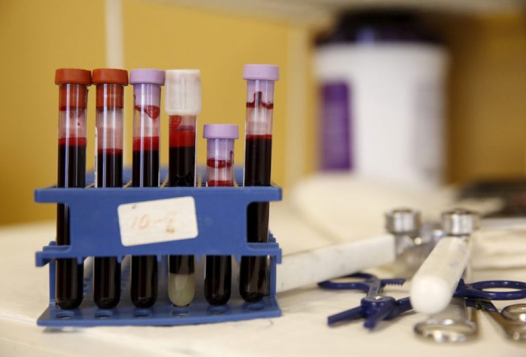 Ovarian cancer blood test misses some Black and Native American patients, study finds